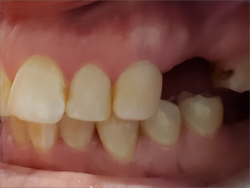 Professional Dentistry Kiln Creek, VA Smiles of Kiln Creek